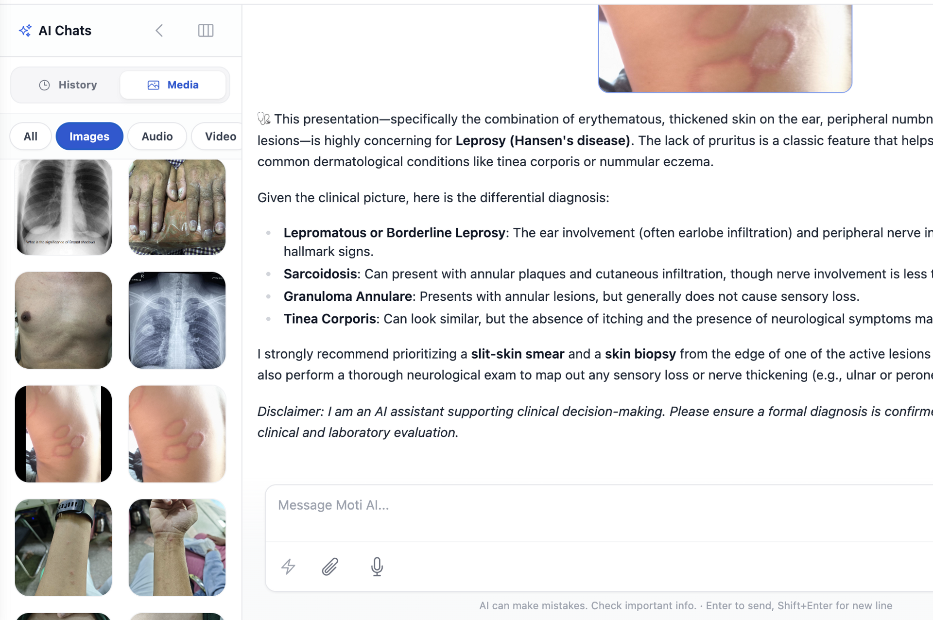 Clinical AI Suite interface